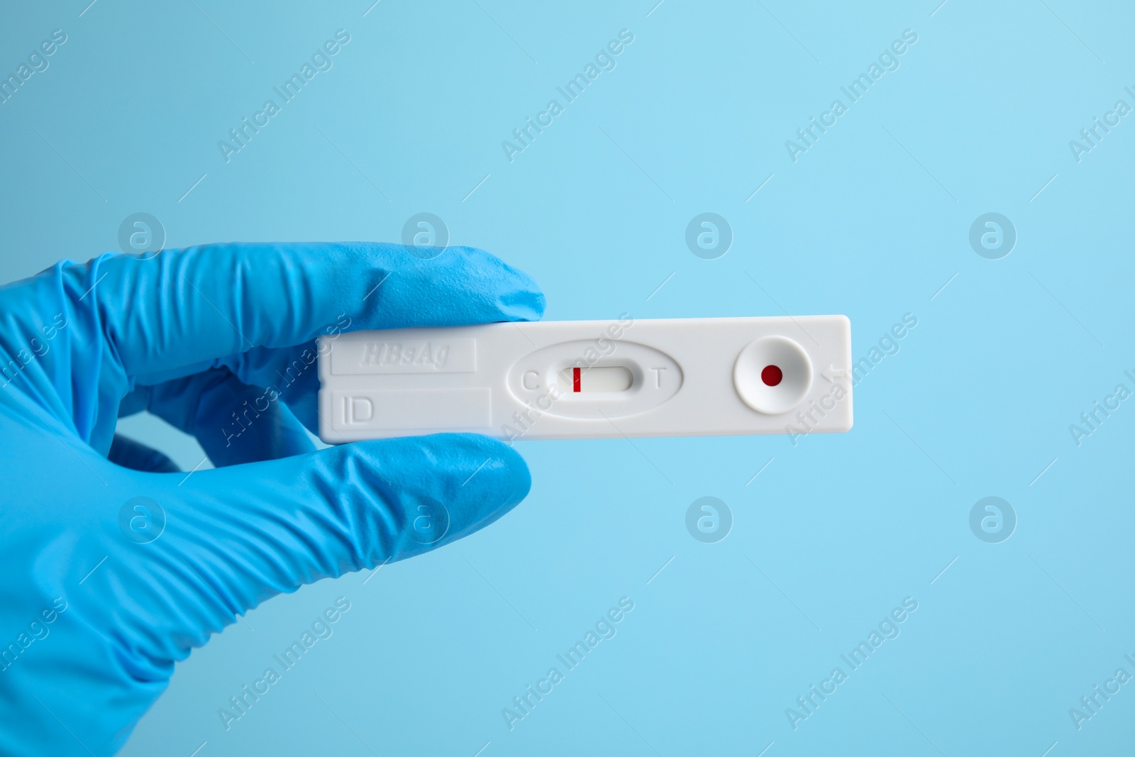 Photo of Doctor holding disposable express test for hepatitis on light blue background, closeup