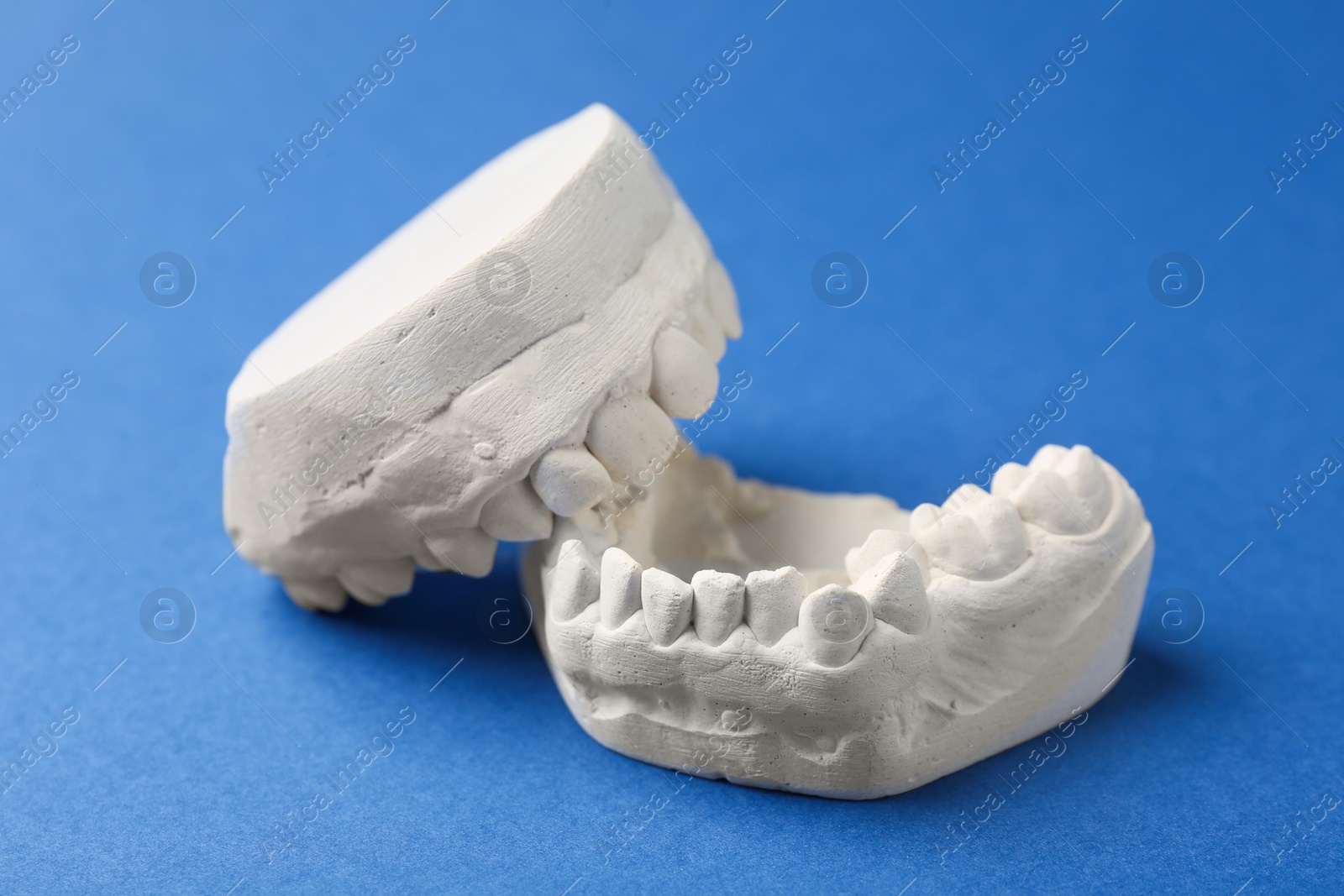 Photo of Dental model with gums on blue background. Cast of teeth