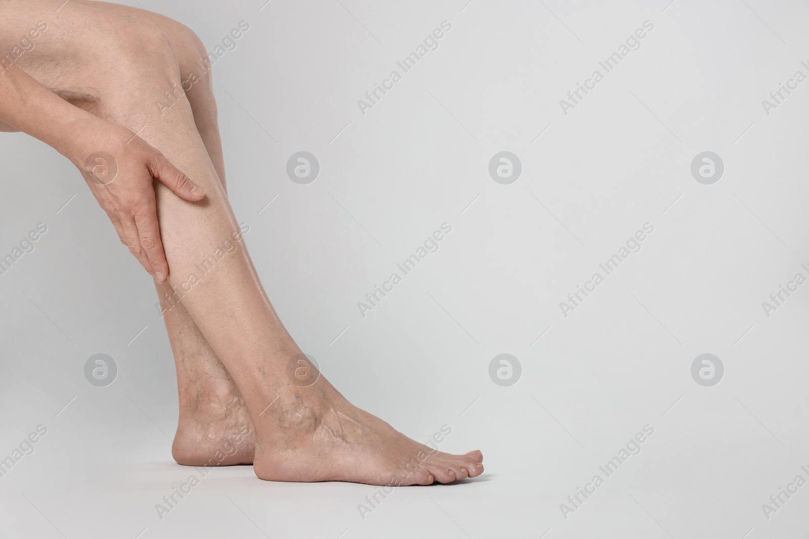 Photo of Closeup view of woman suffering from varicose veins on light background. Space for text