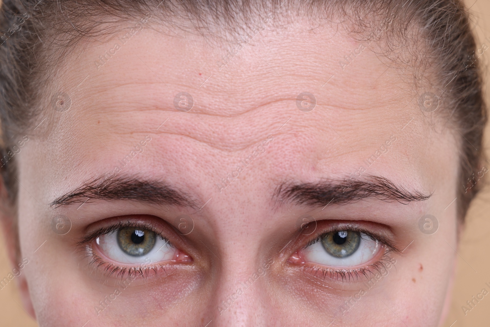 Photo of Closeup view of woman with wrinkles on her forehead