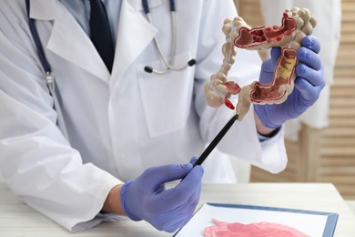 Photo of Doctor showing model of large intestine at white table indoors, closeup