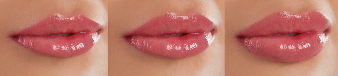 Image of Lip correction procedure stages, banner design. Woman with beautiful lips, closeup