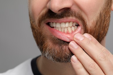 Photo of Man showing his healthy teeth and gums on grey background, closeup