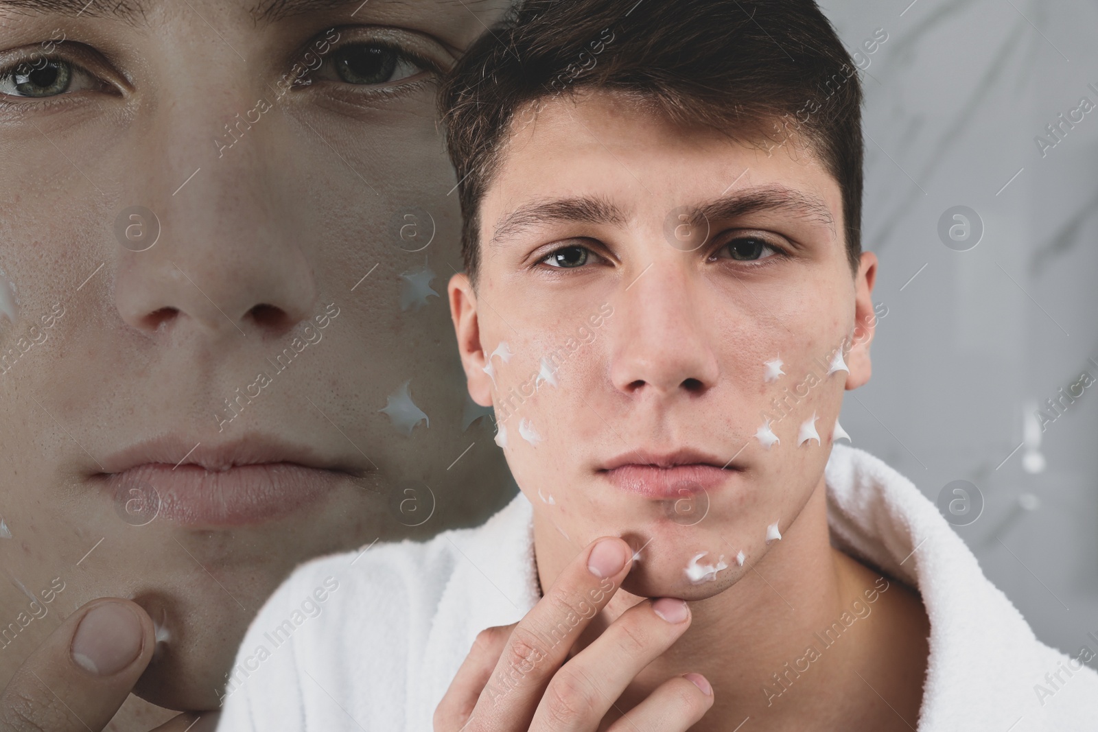 Image of Teenage guy with problem skin applying cream in bathroom. Acnephobia 