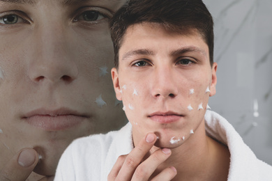 Teenage guy with problem skin applying cream in bathroom. Acnephobia 