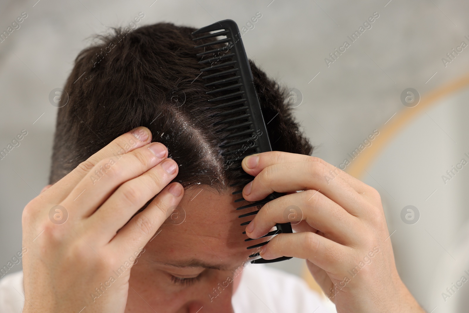 Photo of Dandruff problem. Man with comb examining his hair and scalp on light background, closeup