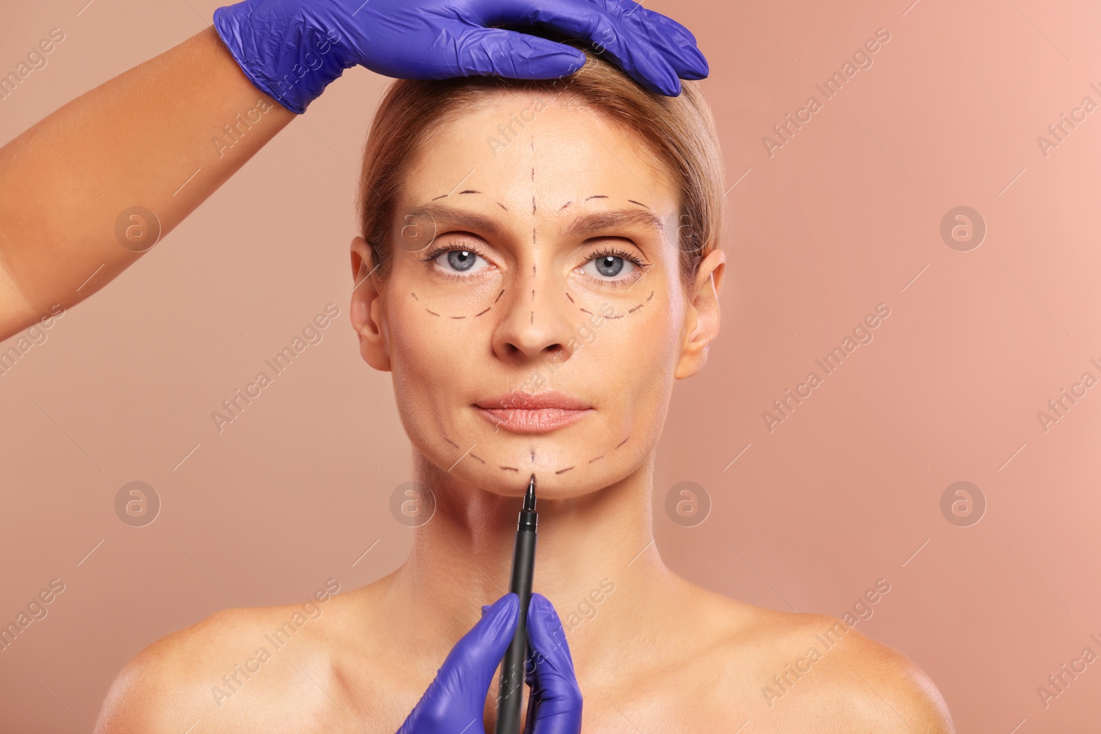 Photo of Doctor with marker preparing patient for cosmetic surgery operation on light brown background