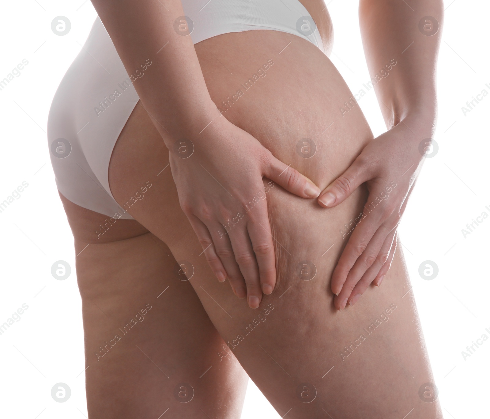 Photo of Woman with cellulite on white background, closeup