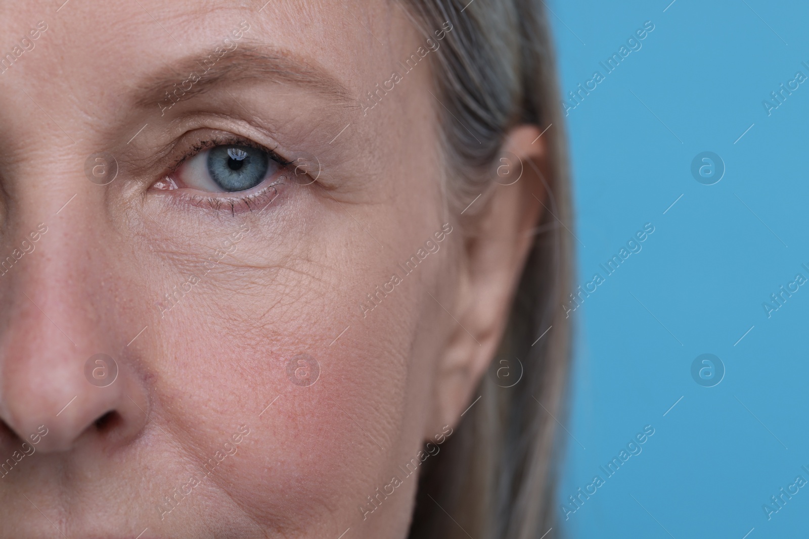 Photo of Senior woman with aging skin on light blue background, closeup. Rejuvenation treatment