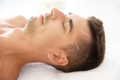 Young man undergoing acupuncture treatment in salon, closeup