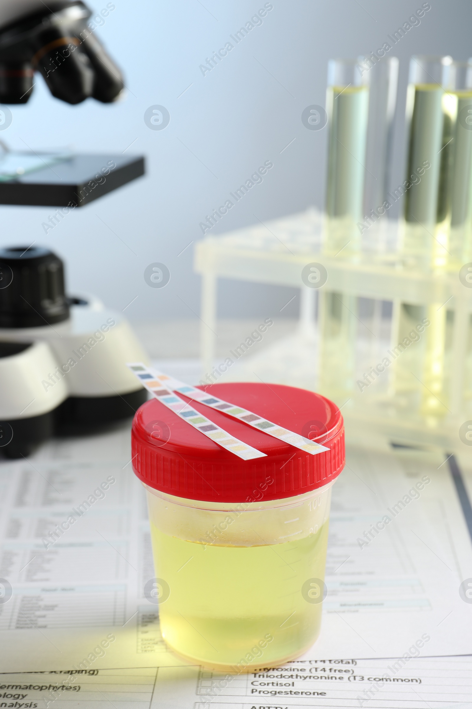 Photo of Container with urine sample for analysis on test forms in laboratory