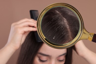 Woman suffering from dandruff on pale brown background, closeup. View through magnifying glass on hair with flakes