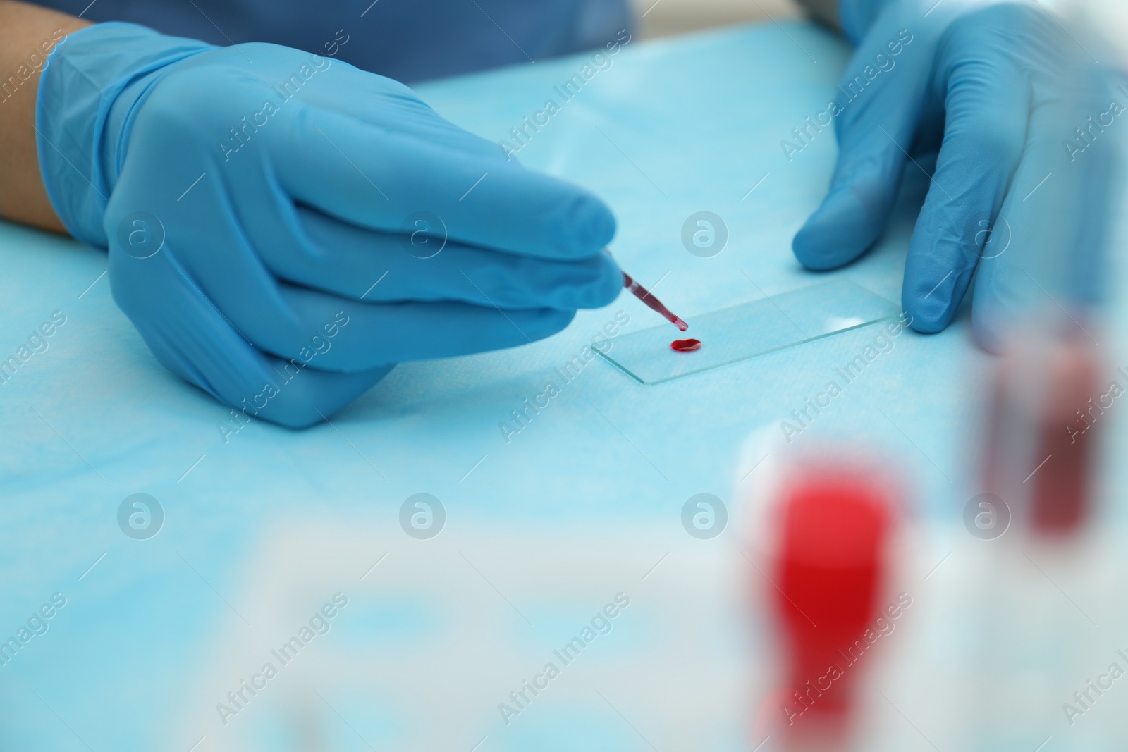 Photo of Doctor with blood sample from finger at table, closeup
