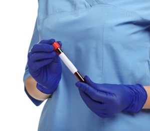 Photo of Laboratory testing. Doctor with blood sample in tube on white background, closeup