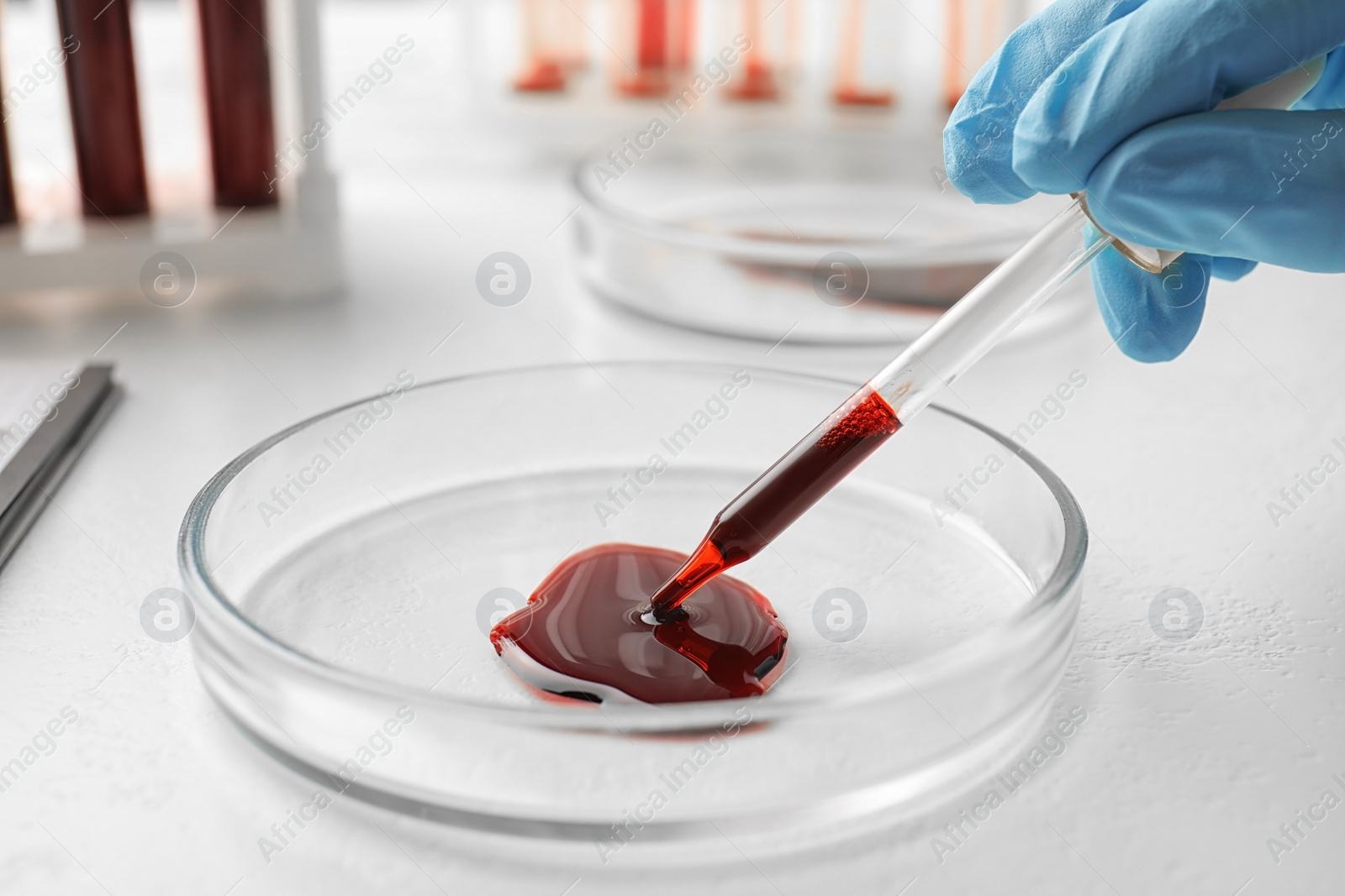 Image of Scientist dripping blood from pipette into Petri dish at table, closeup. Laboratory analysis