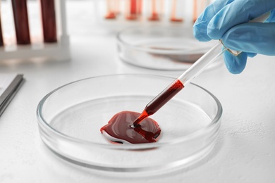 Image of Scientist dripping blood from pipette into Petri dish at table, closeup. Laboratory analysis