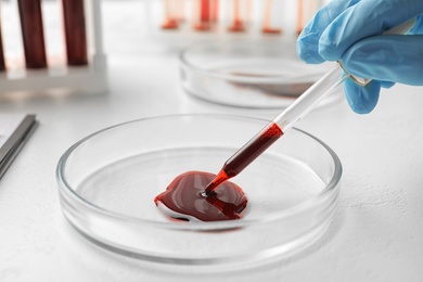 Scientist dripping blood from pipette into Petri dish at table, closeup. Laboratory analysis