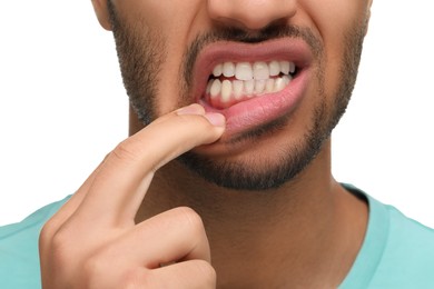 Man showing his healthy teeth and gums on white background, closeup