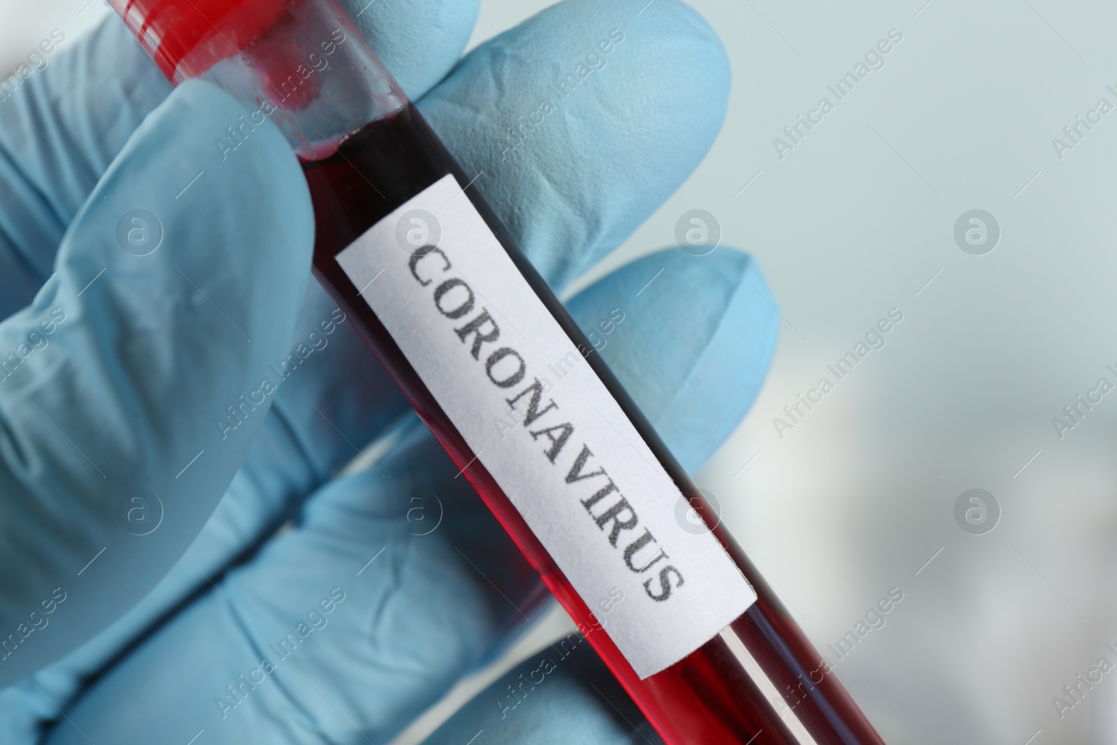 Photo of Doctor holding test tube with blood sample and label CORONAVIRUS in laboratory, closeup of hand