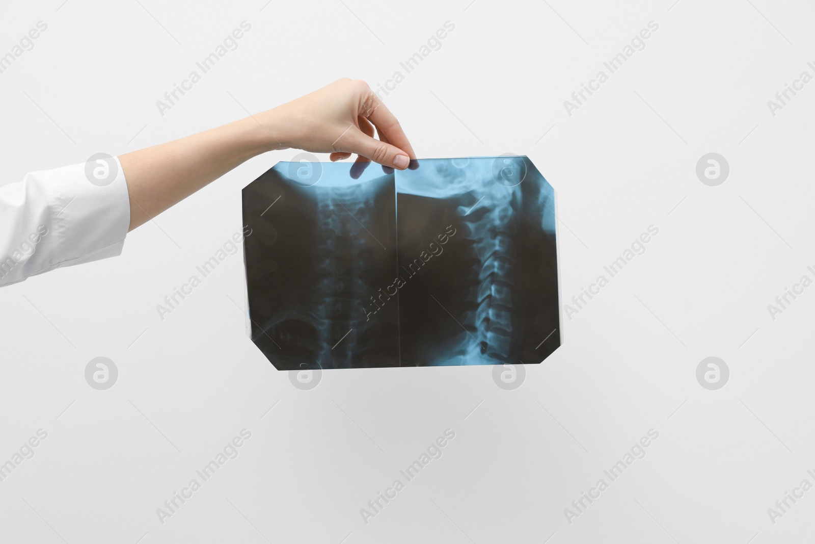 Photo of Doctor examining neck MRI image on light grey background, closeup