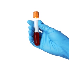 Photo of Laboratory worker holding test tube with blood sample for analysis isolated on white, closeup