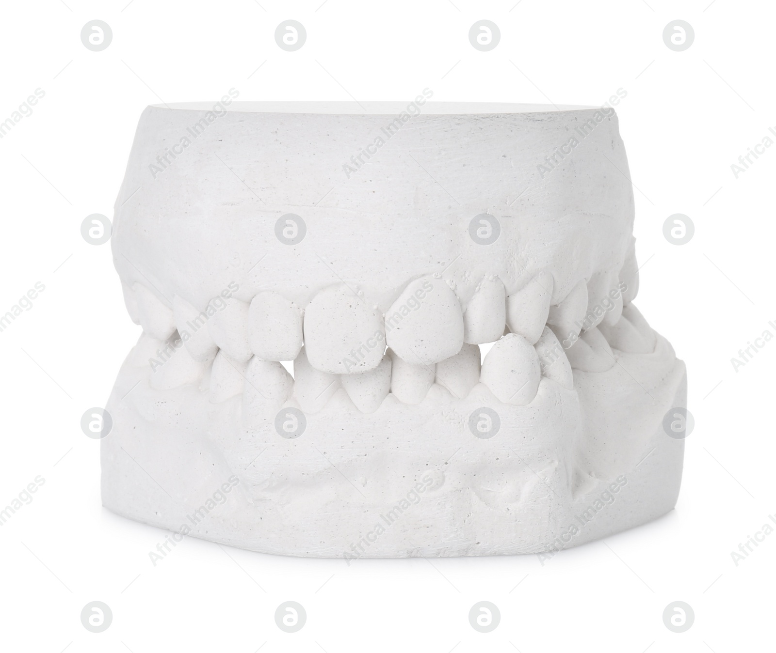 Photo of Dental model with gums isolated on white. Cast of teeth