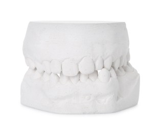 Photo of Dental model with gums isolated on white. Cast of teeth