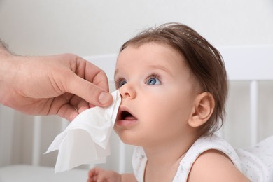Photo of Father wiping runny nose of little baby with napkin on bed, closeup