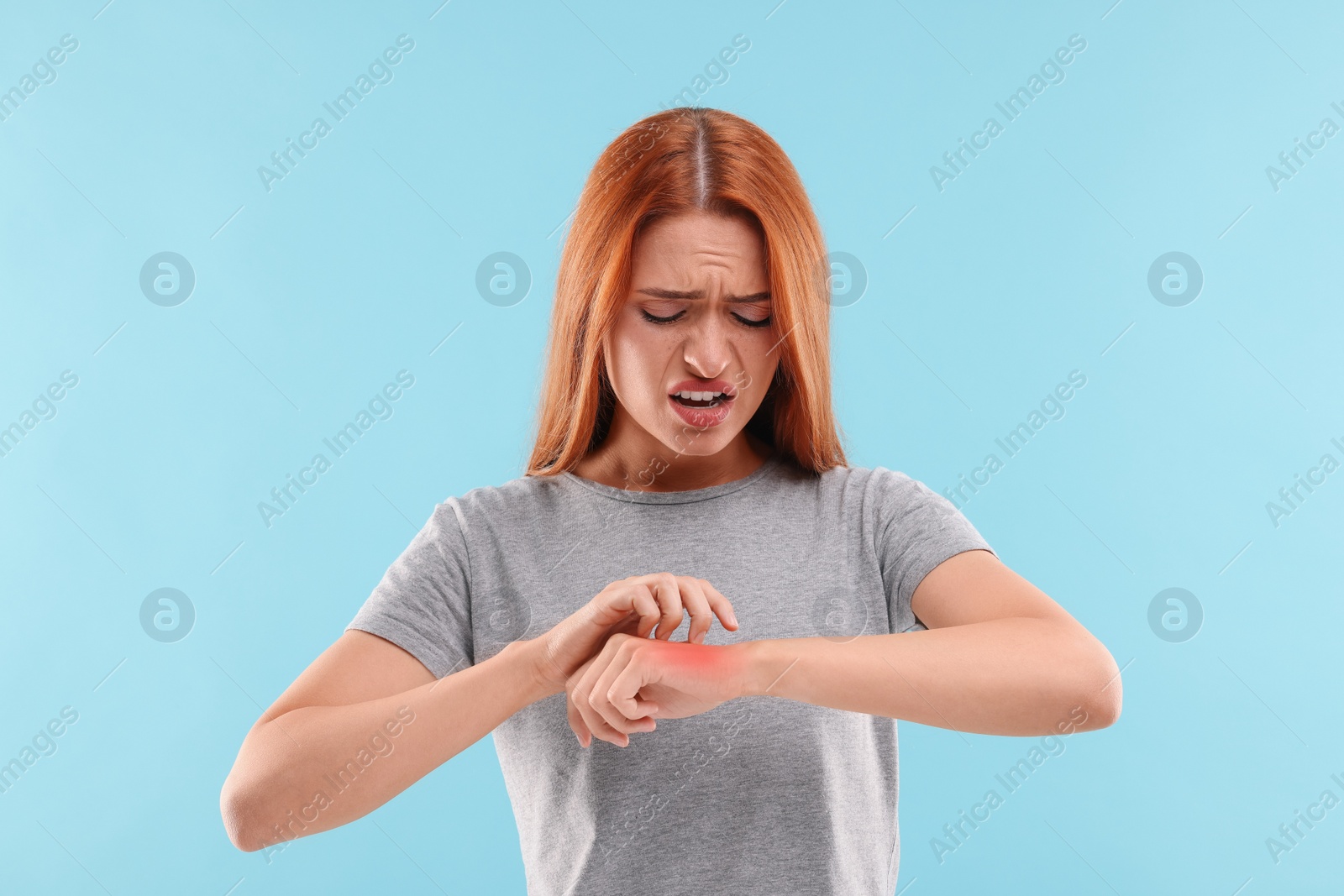 Photo of Suffering from allergy. Young woman scratching her arm on light blue background