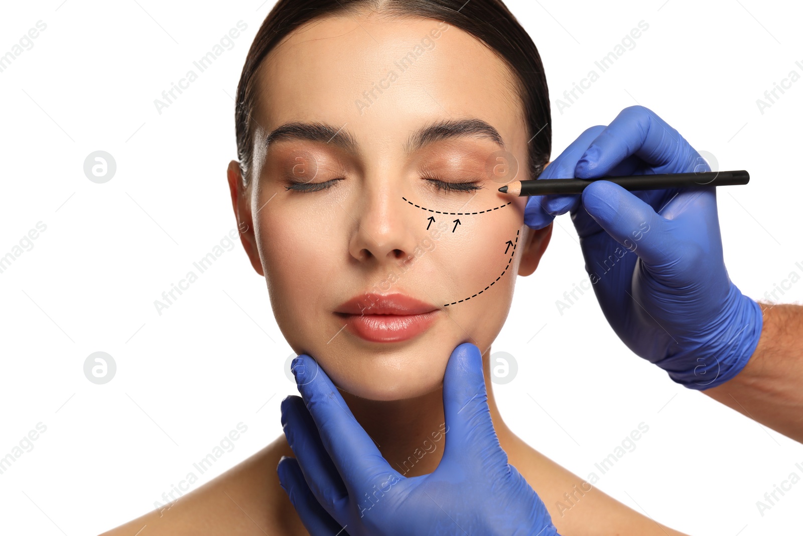 Image of Woman preparing for cosmetic surgery, white background. Doctor drawing markings on her face, closeup