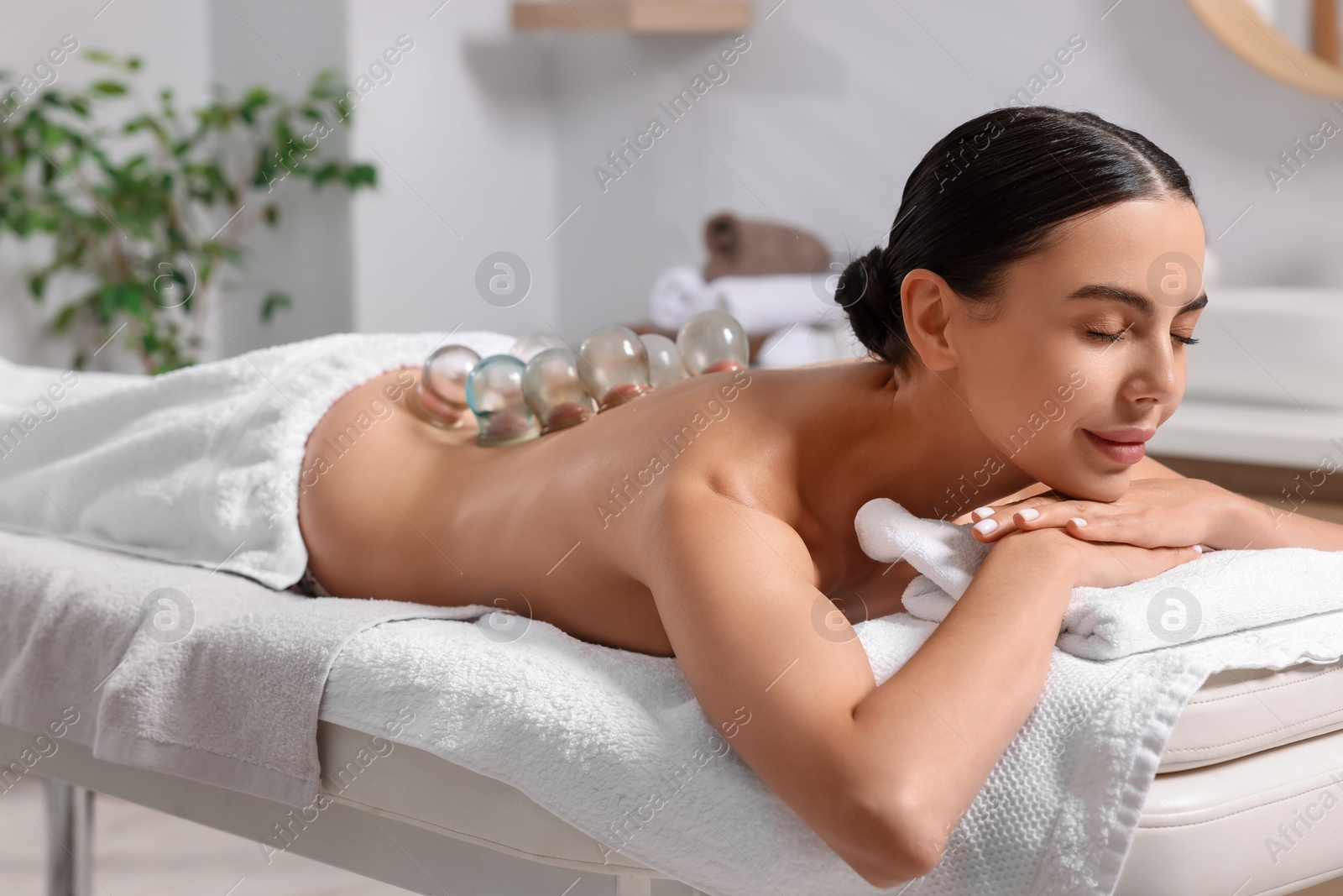 Photo of Cupping therapy. Woman with glass cups on massage couch in spa salon