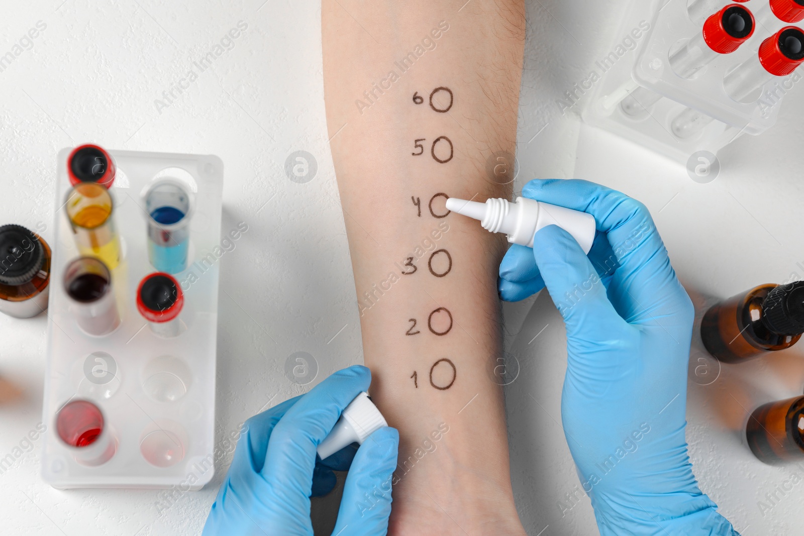 Photo of Doctor doing skin allergy test at light table, top view