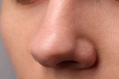 Photo of Young woman with acne problem, closeup view of nose