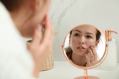 Teen girl applying acne healing patch using mirror indoors