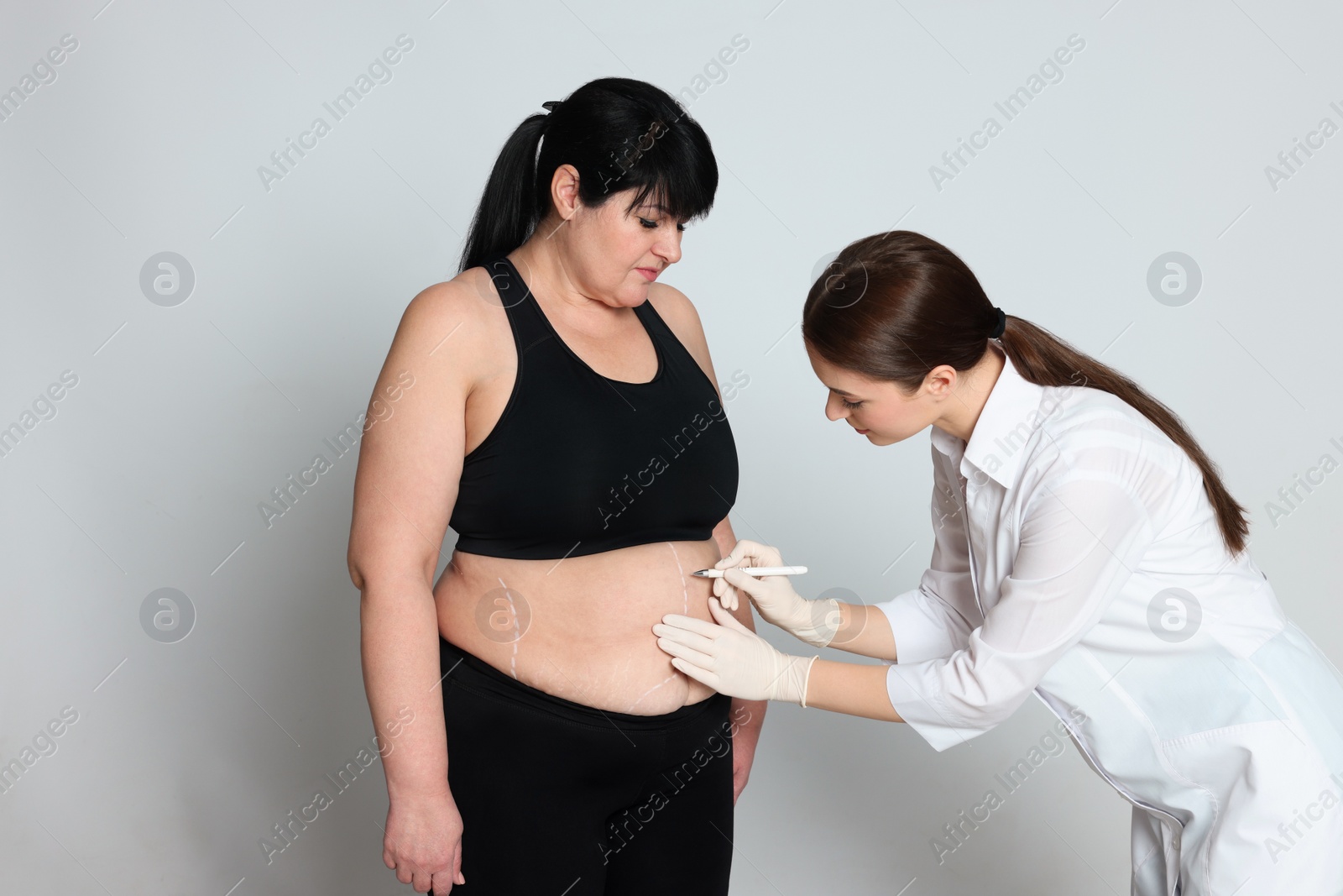 Photo of Doctor drawing marks on obese woman's body against light background. Weight loss surgery