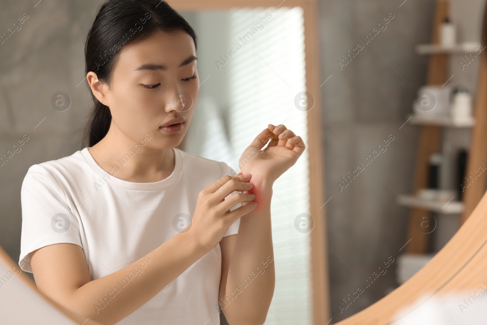 Photo of Suffering from allergy. Young woman scratching her arm near mirror in bathroom, space for text