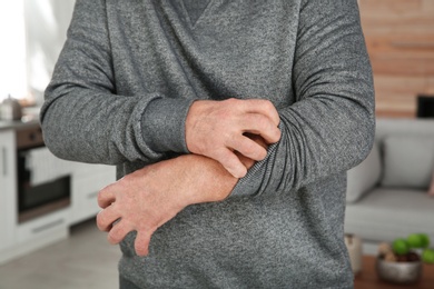 Photo of Mature man scratching arm at home, closeup. Annoying itch