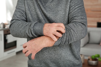 Mature man scratching arm at home, closeup. Annoying itch