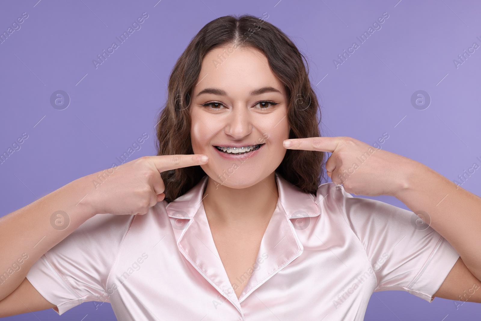 Photo of Smiling woman pointing at braces on her teeth against violet background