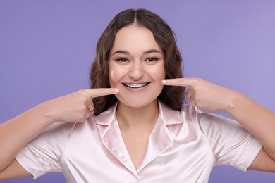 Photo of Smiling woman pointing at braces on her teeth against violet background