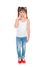 Photo of Little girl with chickenpox on white background