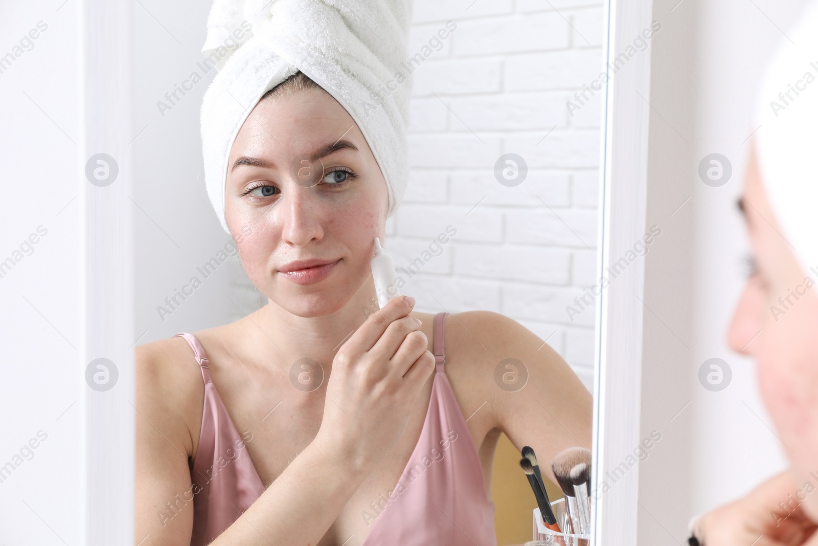 Photo of Woman with acne problem applying cream near mirror indoors