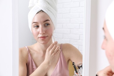 Woman with acne problem applying cream near mirror indoors