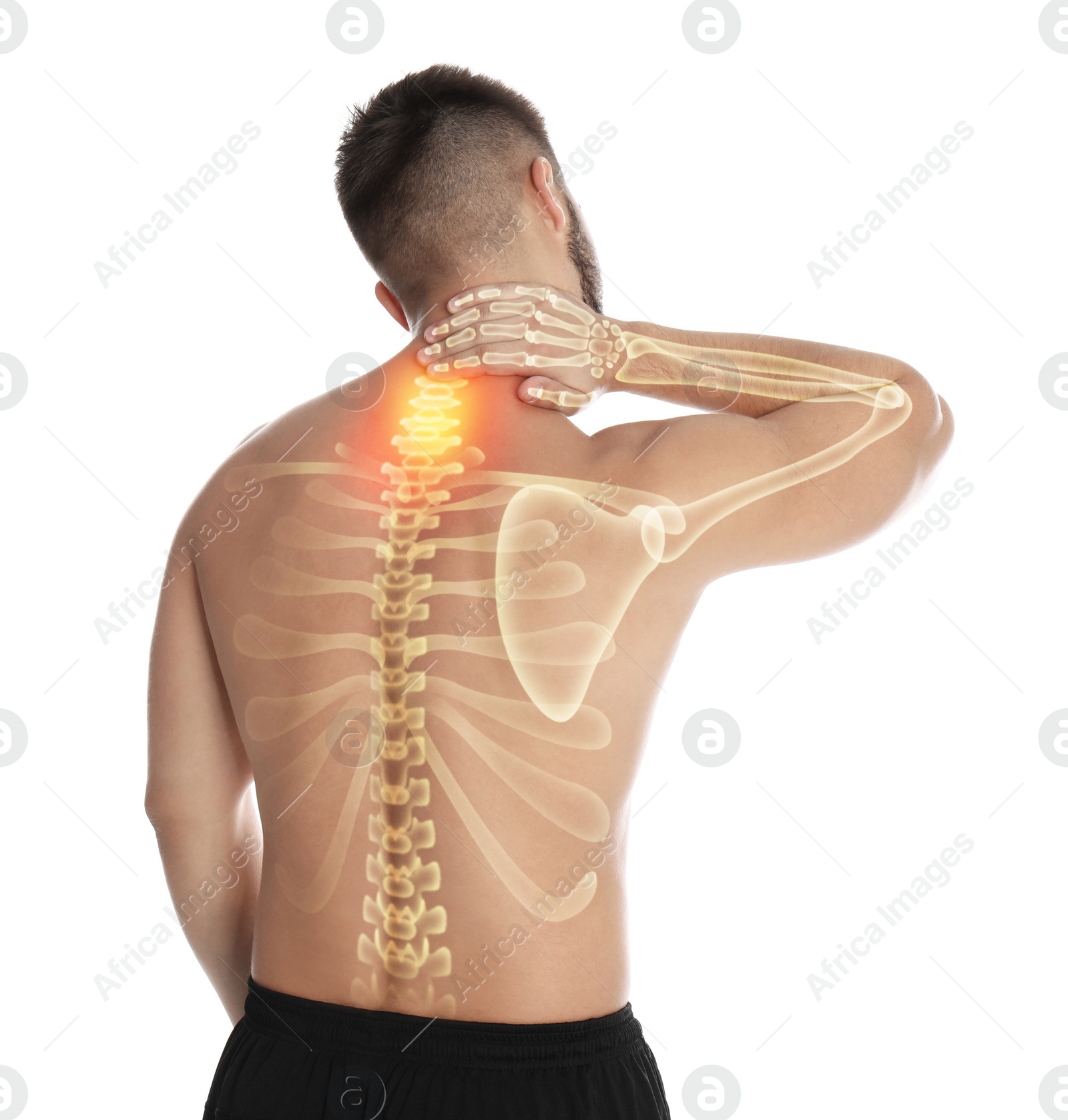 Image of Man having neck pain on white background. Digital compositing with illustration of spine 
