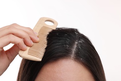 Photo of Woman with comb examining her hair and scalp on white background, closeup. Dandruff problem
