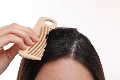 Woman with comb examining her hair and scalp on white background, closeup. Dandruff problem