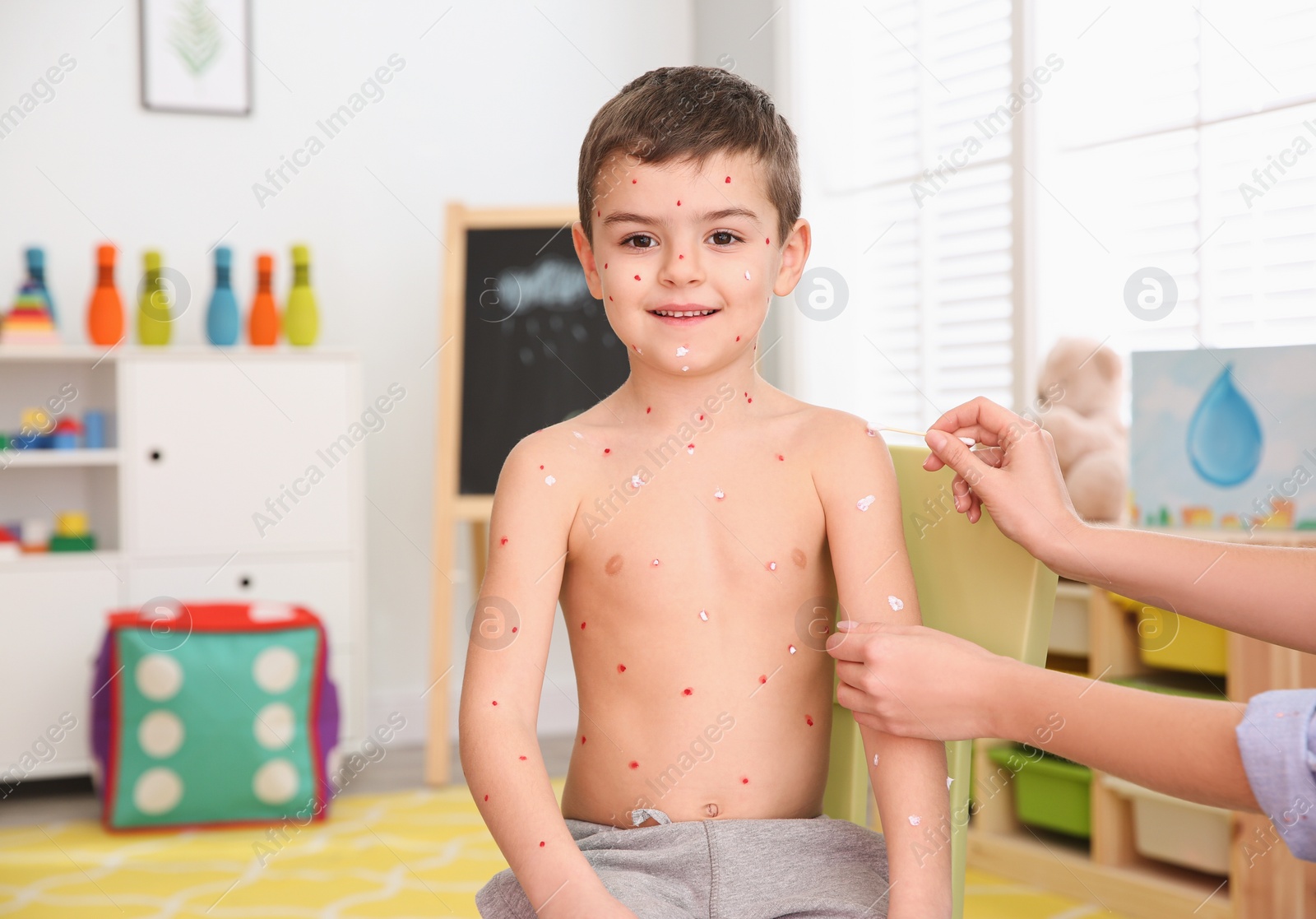 Photo of Woman applying cream onto skin of little boy with chickenpox at home