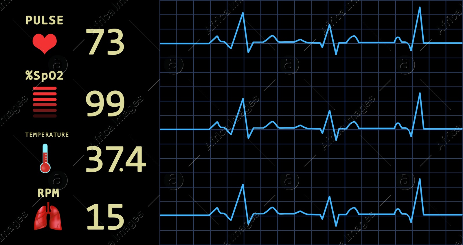 Illustration of Cardiogram and data on display of heart rate monitor. Illustration