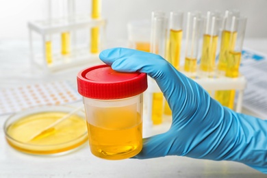 Photo of Laboratory worker holding jar with urine sample near table. Urology concept