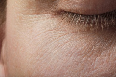 Photo of Closeup view of woman with normal skin